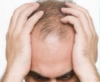 د بدن د معافیتي سیستم پیاوړتیا د ویښتانو د بیرته را ختو سبب کېږي