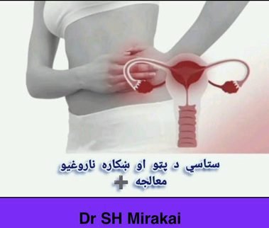 ښځینه ناروغي | ډاکتر ش میرهکی