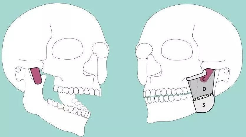 د مزاج د ناببره بدلون اختلال’ څه شی دی؟