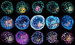 مسټ حجرې mast cells